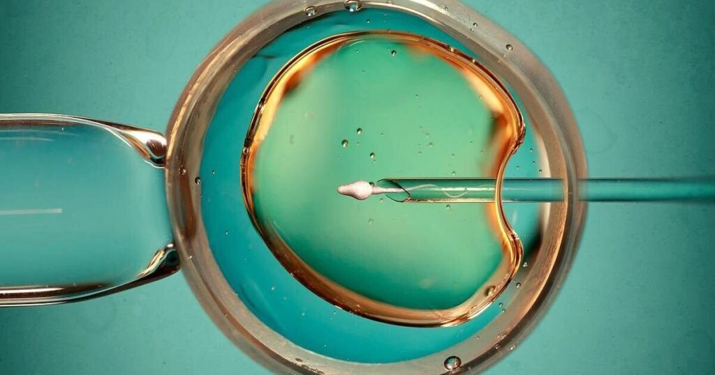 Donor Eggs Essential For Successful IVF After 40, Study Finds Donor Eggs Essential For Successful IVF After 40, Study Finds