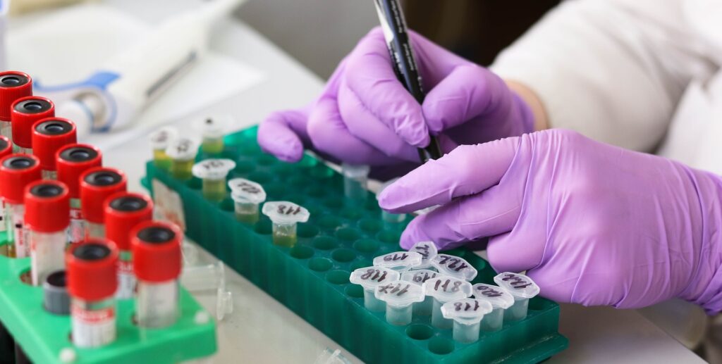 Novel approach restores sperm production in mouse model of infertility